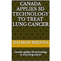 Canada applies 3D technology to treat lung cancer: Canada applies 3D technology to treat lung cancer