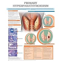Primary Hyperparathyroidism e chart: Full illustrated