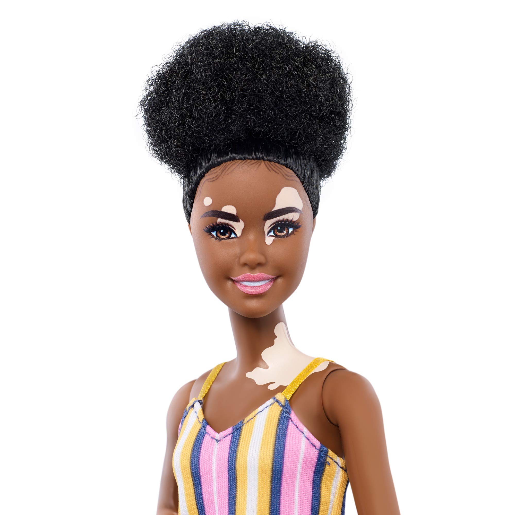 Barbie Fashionistas Doll with Vitiligo and Curly Brunette Hair Wearing Striped Dress and Accessories, for 3 to 8 Year Olds​