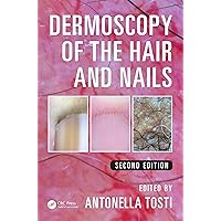 Dermoscopy of the Hair and Nails Dermoscopy of the Hair and Nails Kindle Hardcover