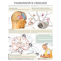 Parkinson´s disease e chart: Full illustrated