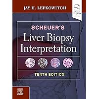 Scheuer's Liver Biopsy Interpretation Scheuer's Liver Biopsy Interpretation Hardcover Kindle