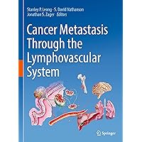 Cancer Metastasis Through the Lymphovascular System: A Comprehensive Textbook Cancer Metastasis Through the Lymphovascular System: A Comprehensive Textbook Hardcover Kindle Paperback