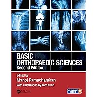 Basic Orthopaedic Sciences Basic Orthopaedic Sciences Paperback Kindle Hardcover