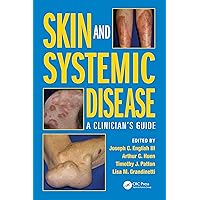 Skin and Systemic Disease: A Clinician’s Guide Skin and Systemic Disease: A Clinician’s Guide Kindle Hardcover
