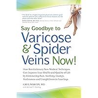 Say Goodbye to Varicose & Spider Veins Now! Say Goodbye to Varicose & Spider Veins Now! Paperback Kindle