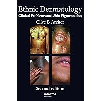 Ethnic Dermatology: Clinical Problems and Skin Pigmentation Ethnic Dermatology: Clinical Problems and Skin Pigmentation Kindle Hardcover Paperback