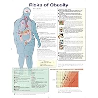 Risks of Obesity Anatomical Chart Laminated