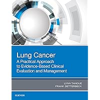 Lung Cancer: A Practical Approach to Evidence-Based Clinical Evaluation and Management Lung Cancer: A Practical Approach to Evidence-Based Clinical Evaluation and Management Kindle Paperback
