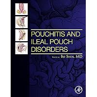 Pouchitis and Ileal Pouch Disorders: A Multidisciplinary Approach for Diagnosis and Management Pouchitis and Ileal Pouch Disorders: A Multidisciplinary Approach for Diagnosis and Management Kindle Hardcover