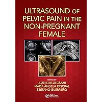 Ultrasound of Pelvic Pain in the Non-Pregnant Patient Ultrasound of Pelvic Pain in the Non-Pregnant Patient Kindle Hardcover Paperback