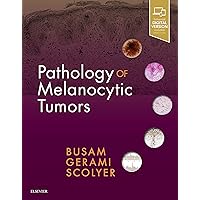 Pathology of Melanocytic Tumors Pathology of Melanocytic Tumors Hardcover Kindle