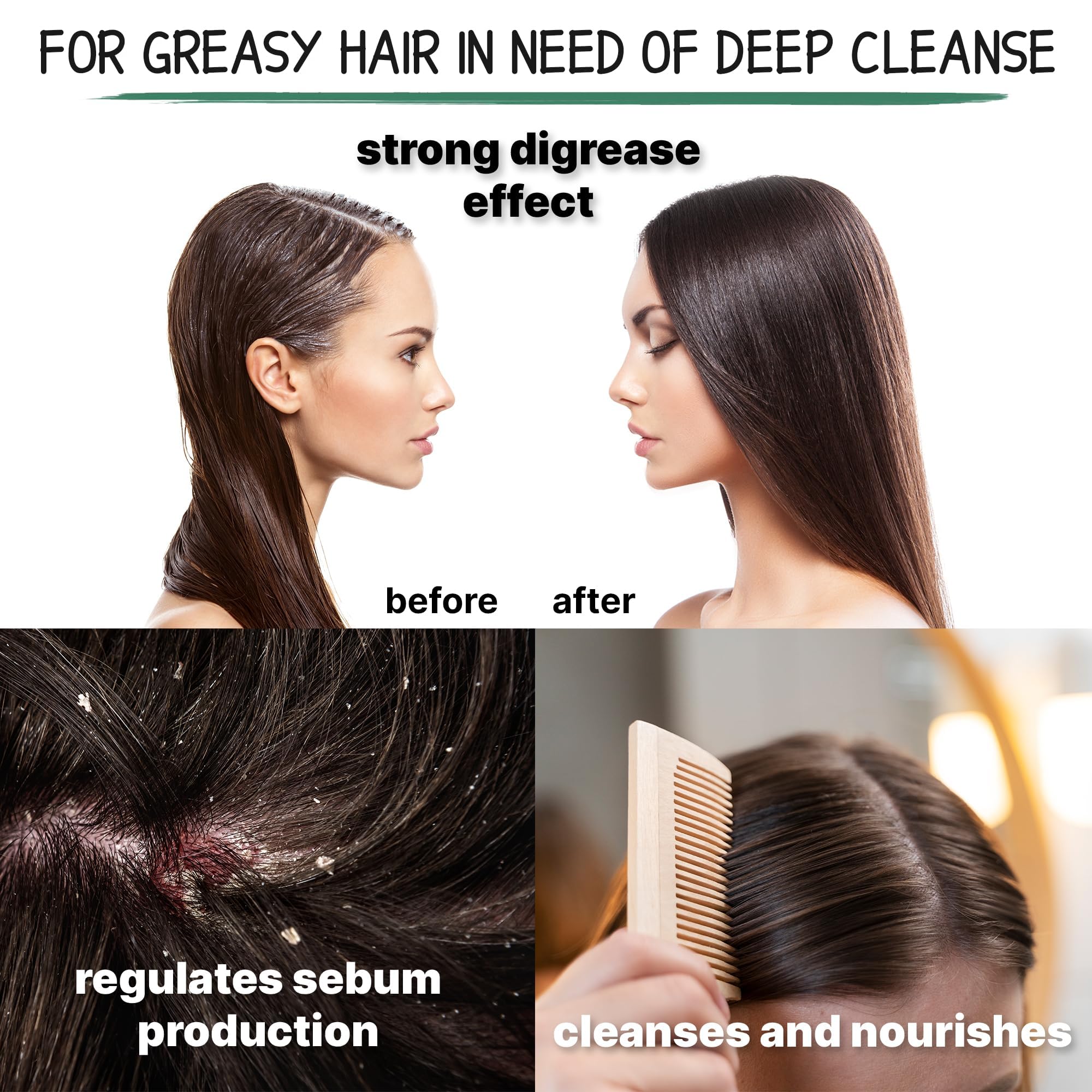 Nettle Shampoo - Helps Regulate Sebum Production, Reduce Dandruff & Ease Scalp Irritation - For Strong, Healthy Hair- 200ml