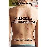Comprehensive Guide to Varicella: From Prevention to Treatment (Medical care and health) Comprehensive Guide to Varicella: From Prevention to Treatment (Medical care and health) Kindle Paperback