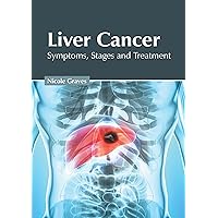 Liver Cancer: Symptoms, Stages and Treatment Liver Cancer: Symptoms, Stages and Treatment Hardcover