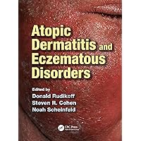 Atopic Dermatitis and Eczematous Disorders Atopic Dermatitis and Eczematous Disorders Kindle Hardcover Paperback