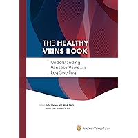 The Healthy Veins Book: Understanding Varicose Veins and Leg Swelling The Healthy Veins Book: Understanding Varicose Veins and Leg Swelling Hardcover Kindle