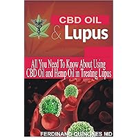CBD OIL & LUPUS: All you need to know about using CBD Oil and Hemp oil in treating lupus CBD OIL & LUPUS: All you need to know about using CBD Oil and Hemp oil in treating lupus Kindle Paperback