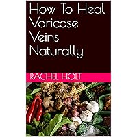 How To Heal Varicose Veins Naturally