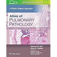 Atlas of Pulmonary Pathology: A Pattern Based Approach Atlas of Pulmonary Pathology: A Pattern Based Approach Hardcover Kindle