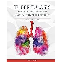 Tuberculosis and Nontuberculous Mycobacterial Infections (ASM Books) Tuberculosis and Nontuberculous Mycobacterial Infections (ASM Books) Hardcover Kindle