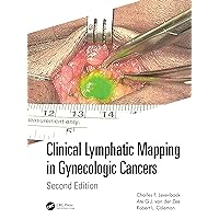 Clinical Lymphatic Mapping in Gynecologic Cancers Clinical Lymphatic Mapping in Gynecologic Cancers Hardcover Kindle