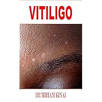 Dermatology: Vitiligo (Skin Diseases Book 1) Dermatology: Vitiligo (Skin Diseases Book 1) Kindle