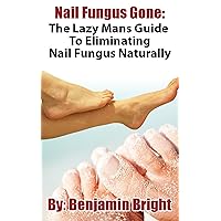 Nail Fungus Treatment:The Lazy Man Guide To Curing Nail Fungus Infections Naturally