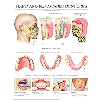 Fixed and removable dentures e chart: Full illustrated