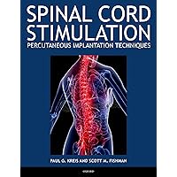 Spinal Cord Stimulation: Percutaneous Implantation Techniques Spinal Cord Stimulation: Percutaneous Implantation Techniques Kindle Hardcover Paperback