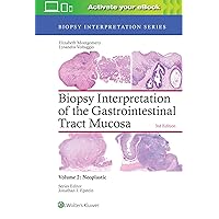 Biopsy Interpretation of the Gastrointestinal Tract Mucosa: Volume 2: Neoplastic (Biopsy Interpretation Series) Biopsy Interpretation of the Gastrointestinal Tract Mucosa: Volume 2: Neoplastic (Biopsy Interpretation Series) Hardcover Kindle