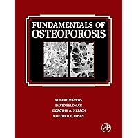 Fundamentals of Osteoporosis Fundamentals of Osteoporosis Kindle Hardcover