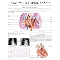 Pulmonary hypertension e chart: Full illustrated