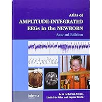 An Atlas of Amplitude-Integrated EEGs in the Newborn (Encyclopedia of Visual Medicine Series) An Atlas of Amplitude-Integrated EEGs in the Newborn (Encyclopedia of Visual Medicine Series) Hardcover Kindle