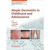 Atopic Dermatitis in Childhood and Adolescence (Pediatric and Adolescent Medicine Book 15) Atopic Dermatitis in Childhood and Adolescence (Pediatric and Adolescent Medicine Book 15) Kindle Hardcover