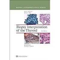 Biopsy Interpretation of the Thyroid (Biopsy Interpretation Series) Biopsy Interpretation of the Thyroid (Biopsy Interpretation Series) Kindle Hardcover