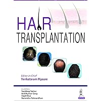 Hair Transplantation Hair Transplantation Kindle Hardcover