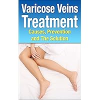 Varicose Veins Treatment (Health and Wellness Book 1) Varicose Veins Treatment (Health and Wellness Book 1) Kindle