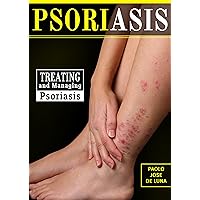 Psoriasis: Treating and Managing Psoriasis: What You need to Know About Psoriasis Psoriasis: Treating and Managing Psoriasis: What You need to Know About Psoriasis Kindle Paperback Mass Market Paperback