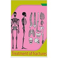 Treatment of fractures: FOR MAN AND WOMAN who suffer from a fracture in one of the bones