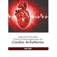 Mechanism and Clinical Management of Cardiac Arrhythmias