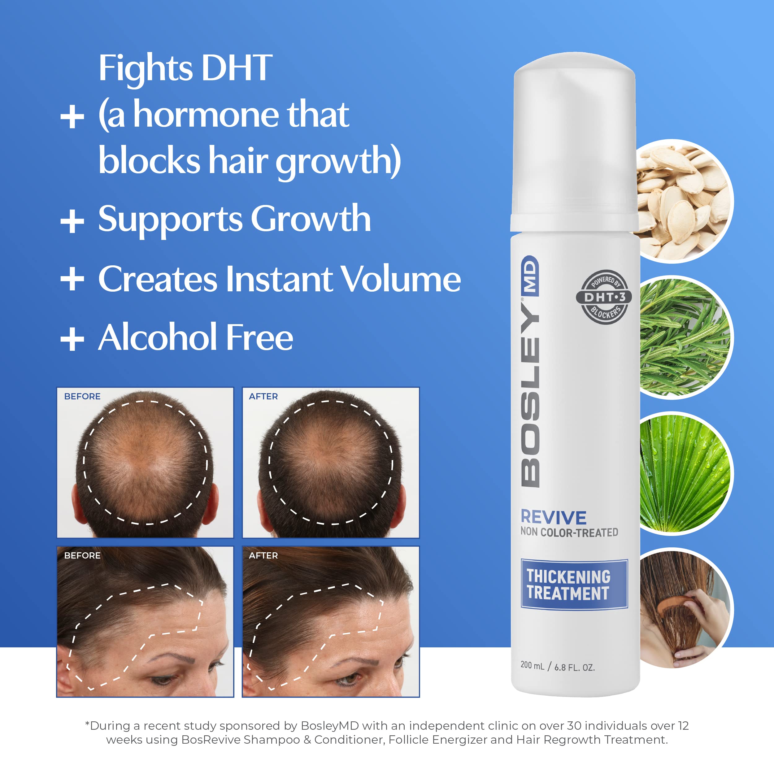 BosleyMD Thickening Treatment, Foaming Solution for Thinning Prevention, Hair Regrowth, Visible Hair Loss, Professional Hair Care Product, 6.8 oz. and 3.4 oz.