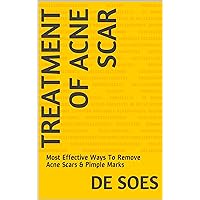 Treatment of Acne Scar: Most Effective Ways To Remove Acne Scars & Pimple Marks