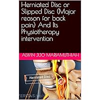 Herniated Disc or Slipped Disc (Major reason for back pain) And Its Physiotherapy intervention