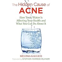 The Hidden Cause of Acne: How Toxic Water Is Affecting Your Health and What You Can Do about It The Hidden Cause of Acne: How Toxic Water Is Affecting Your Health and What You Can Do about It Kindle Paperback