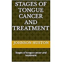 Stages of tongue cancer and treatment: Stages of tongue cancer and treatment