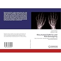 Rheumatoid Arthritis and HLA Genotyping: Role of HLA-DRB1 and HLA-DQB1 in Pathogenesis of Rheumatoid Arthritis