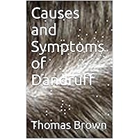 Causes and Symptoms of Dandruff