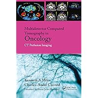 Multi-Detector Computed Tomography in Oncology: CT Perfusion Imaging Multi-Detector Computed Tomography in Oncology: CT Perfusion Imaging Hardcover Kindle