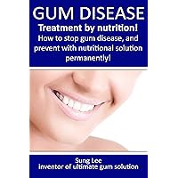 Gum Disease - Treatment by nutrition! How to stop gum disease, and prevent with nutritional solution permanently. (1)